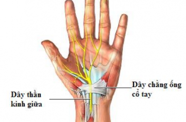 HỘI CHỨNG ỐNG CỔ TAY