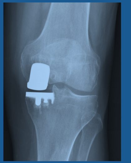 Screen_Shot_2016-11-06_at_9.56.30_PM