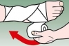 Xử lý ban đầu chấn thương phần mềm