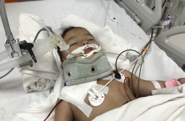 Cứu sống bé gái bị mảnh sành đâm vào cổ