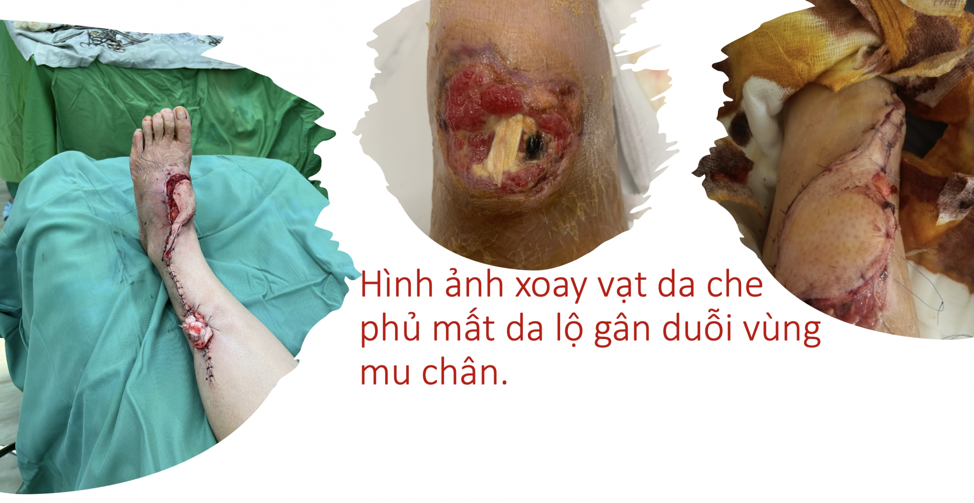 Ynh_man_hinh_2023-01-05_luc_14.15.50