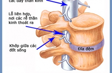 TẬP HUẤN PHẪU THUẬT CỘT SỐNG TRẺ EM NĂM 2017 TẠI BỆNH VIỆN HN VIỆT ĐỨC
