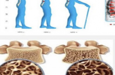 HỘI NGHỊ LOÃNG XƯƠNG
