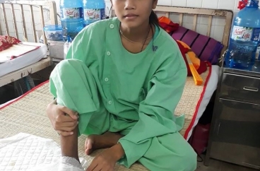 BỆNH NHÂN KHÓ KHĂN: EM MANG THỊ SƯƠNG BỊ RẮN CẮN HOẠI TỬ BÀN CHÂN