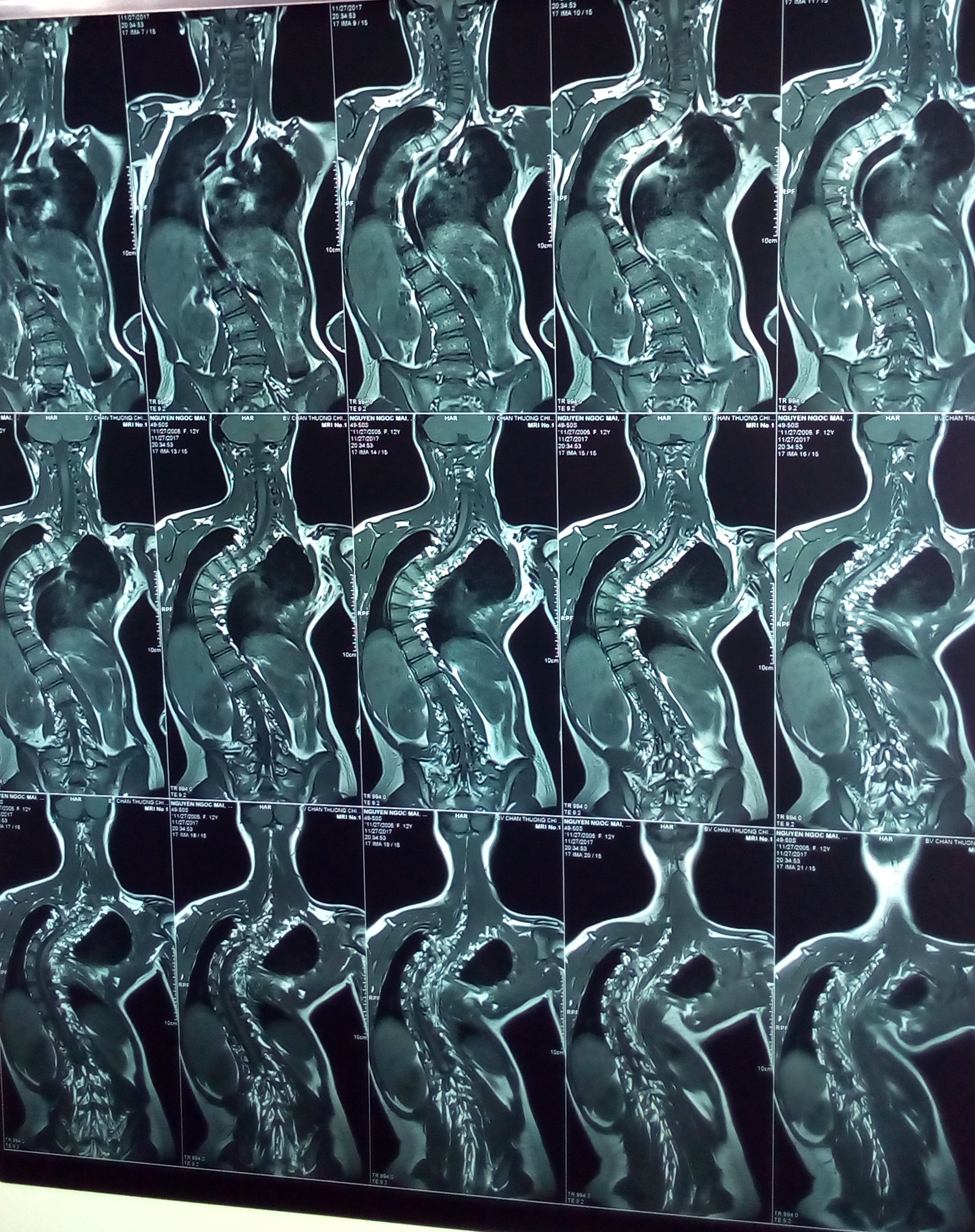 mri_1