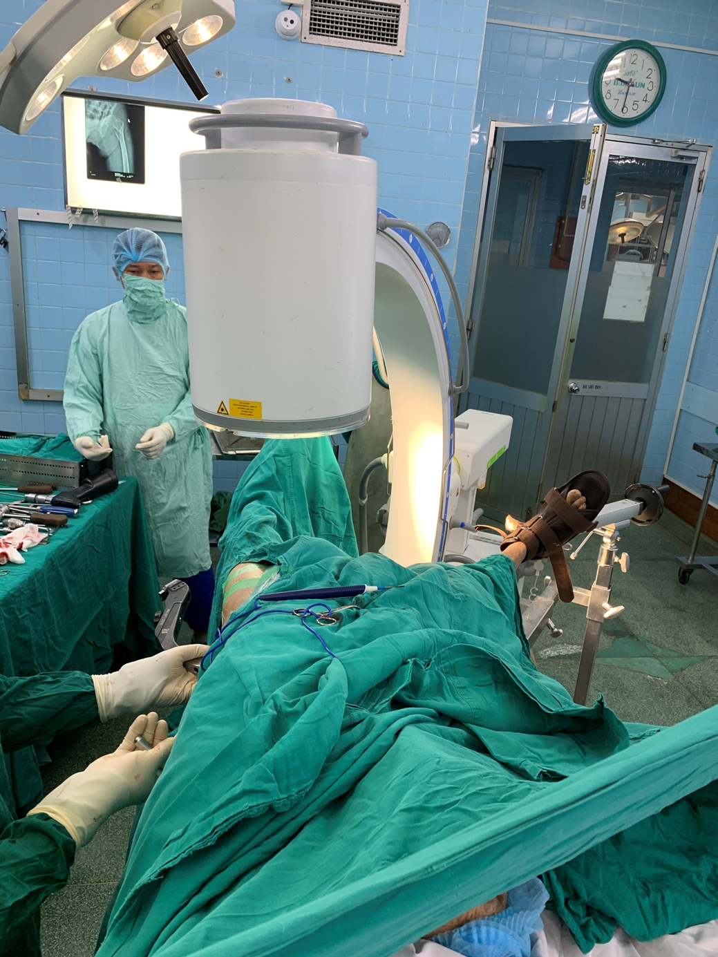 Hình trong lúc phẫu thuật