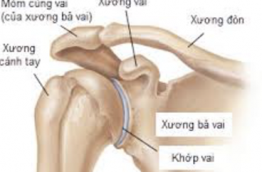 ĐÁNH GIÁ KẾT QUẢ ĐIỀU TRỊ PHẪU THUẬT GÃY 1/3 GIỮA XƯƠNG ĐÒN BẰNG ĐINH KIRSCHNER