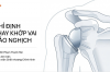 Chỉ định thay khớp vai đảo nghịch