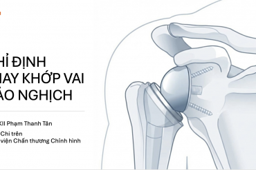 Chỉ định thay khớp vai đảo nghịch