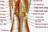 Tổn thương ĐM khoeo trong chấn thương gối