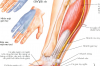 Đánh giá kết quả điều trị phẫu thuật gãy kín LMC xương đùi bằng nẹp vít khóa