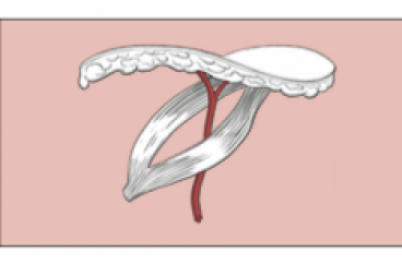 HAND FLAPS